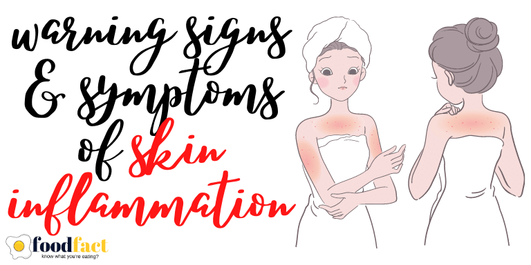 Skin Inflammation - Warning Signs & Symptoms - FOODFACT